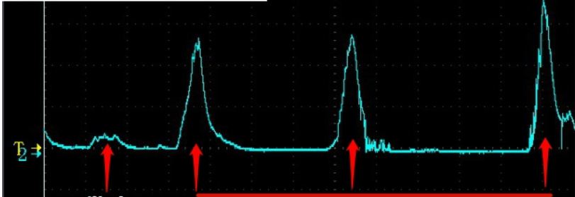 EKG board ชุดขยายสัญญาณ EKG ECG จาก sensor Electrode  + สายพร้อม อิเล็กโทรดครบชุด